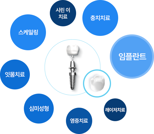 임플란트, 충치치료, 시린 이 치료, 스케일링, 잇몸치료, 심미성형, 입술질환, 입술염증